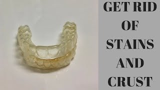 How To Clean Your Retainers [upl. by Vories]