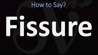 How to Pronounce Fissure CORRECTLY [upl. by Uhile104]