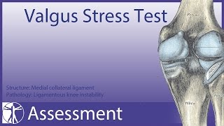 Valgus Stress Test  Medial Collateral Ligament [upl. by Marcile]