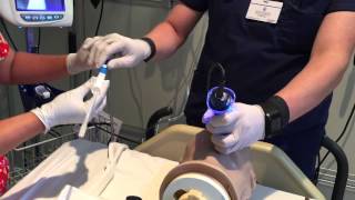 GlideScope Intubation Assist [upl. by Liba]