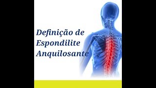 ESPONDILITE ANQUILOSANTE Doença Inflamatória Crônica da Coluna Clínica Fisioterapia Dr Robson Sitta [upl. by Loginov]