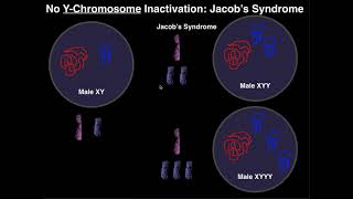 Jacobs Syndrome  A YChromosome Aneuploidy [upl. by Cosme]