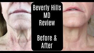 Beverly Hills MD Dermal Repair Complex—Lift and Firm Sculpting Cream—Before and After—AntiAging [upl. by Selry235]