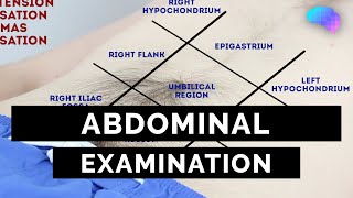 Abdominal Examination  OSCE Guide Latest  UKMLA  CPSA  PLAB 2 [upl. by Carlynne12]