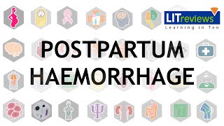 Prevention and Treatment of Postpartum Haemorrhage [upl. by Nayhr]