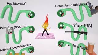 Acute Interstitial Nephritis Mnemonic for the USMLE [upl. by Chung]