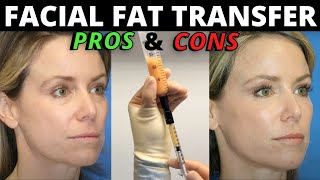 The Pros and Cons of Facial Fat Transfer from Facial Plastic Surgeon Dr Amir Karam [upl. by Ailet]