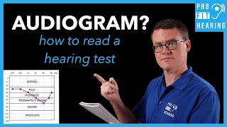 Audiogram  How to Read a Hearing Test [upl. by Ledoux]