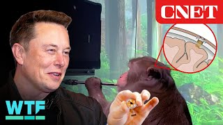 Neuralink Everything to Know About Elon Musks Brain Chip [upl. by Enirhtak]