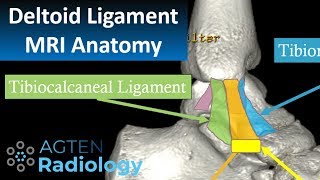 MRI Anatomy of Ankle Ligaments Deltoid Ligament [upl. by Conn]