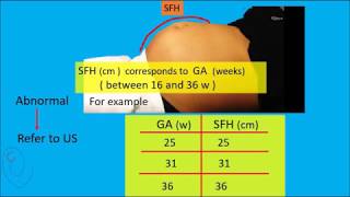 Symphysis Fundal Height  SFH  measurement [upl. by Rod]