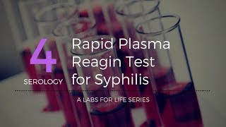 Rapid Plasma Reagin Test for Syphilis [upl. by Rabkin]