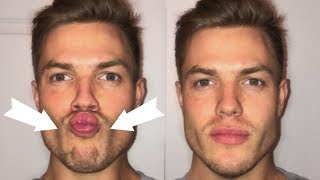 3 Exercises To Lose CHUBBY Cheeks Get a Defined Face [upl. by Ocer]