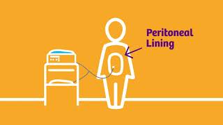 Peritoneal Dialysis Process [upl. by Drews]