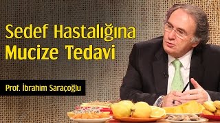 Sedef Hastalığına Mucize Tedavi  Prof İbrahim Saraçoğlu [upl. by Olav917]