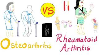 Overview of Rheumatoid arthritis and treatment  Pharmacology [upl. by Llenad]