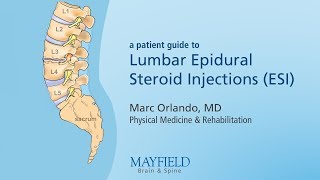 Lumbar Epidural Steroid Injections [upl. by Jesse]