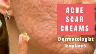 How to CLEAR SEBORRHEIC DERMATITIS on the face Dr Dray [upl. by Olson761]