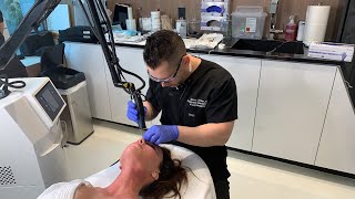 Ablative Erbium Laser for Skin Resurfacing  West Hollywood CA  Dr Jason Emer [upl. by Gerty]