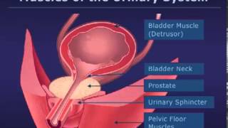 Botox Injections for Bladder Conditions [upl. by Kaiulani]