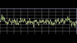 Vision Disorders  Rife Frequencies [upl. by Irrab792]