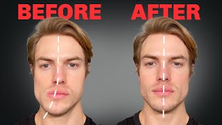 How to Fix Asymmetrical Jaw amp Face FOREVER [upl. by Ulphi]