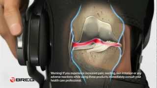 Learn About Knee Osteoarthritis OA [upl. by Tobie876]