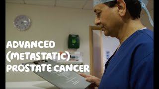 About Advanced Metastatic Prostate Cancer [upl. by Oringas]