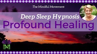 Use Your Powerful Mind Healing Deep Sleep Hypnosis  Mindful Movement [upl. by Minerva]