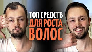 ТОП 5 средств для роста волос от врача дерматолога [upl. by Elora927]