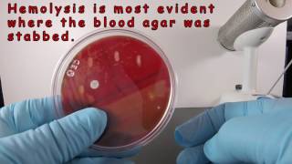 Beta Hemolysis on Blood Agar [upl. by Cicely755]