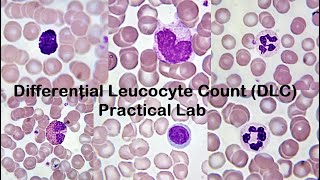 Differential Leucocyte Count DLC Practical Lab [upl. by Assirrac]