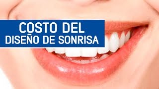 Diseño de sonrisa costo y en que consiste  Odontoespecialistas [upl. by Irakab]