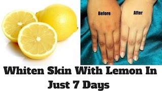 How To Whiten Skin With Lemon In Just 7 Days  Lemon Facial At Home  Lemon For Skin Whitening [upl. by Pretrice831]