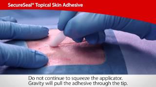 SecureSeal® Topical Skin Adhesive  Cardinal Health [upl. by Akemej]