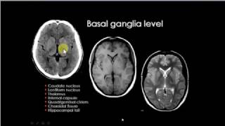 Basal ganglion anatomy [upl. by Readus]