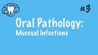 Oral Pathology  Mucosal Infections  INBDE ADAT [upl. by Bissell]