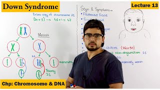 Downs Syndrome  A Genetic Disorder  Lecture 13 [upl. by Damales]