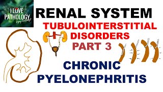 CHRONIC PYELONEPHRITIS  PATHOLOGY [upl. by Nuahsyar]