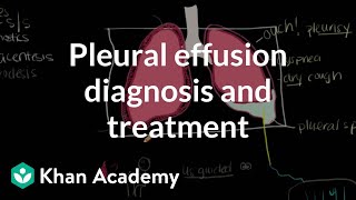 Pleural effusion diagnosis and treatment  Respiratory system diseases  NCLEXRN  Khan Academy [upl. by Alexis]