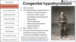 How to identify subclinical hypothyroidism [upl. by Rasmussen179]