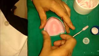 denture base preparation [upl. by Melania]