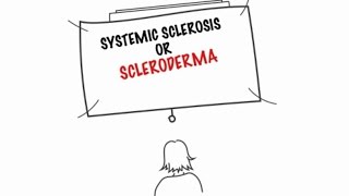 Understanding Systemic Sclerosis [upl. by Alurd]