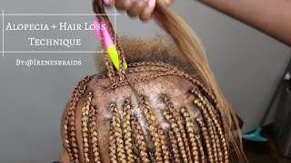 NEW TECHNIQUE ALOPECIA  HAIR LOSS BOX BRAIDS  IRENESBRAIDS [upl. by Loydie]