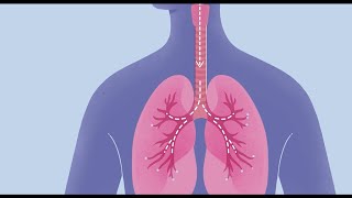 DEFCON 1 Lung Abscess Post Mortem [upl. by Eicam380]