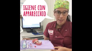 Come lavare i denti con lapparecchio ortodontico [upl. by Aicilav]