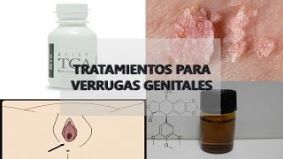 ¿Cómo eliminar verrugas Parte 1 [upl. by Raseta]