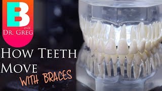 BRACES EXPLAINED How Teeth Move  Braces Work [upl. by Mann734]