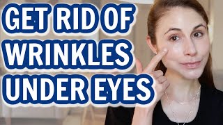 How to GET RID OF UNDER EYE WRINKLES Dr Dray [upl. by Anuat584]