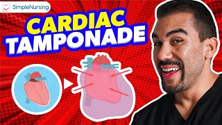 Cardiac Tamponade NCLEX Tips for Nursing Students [upl. by Alec]